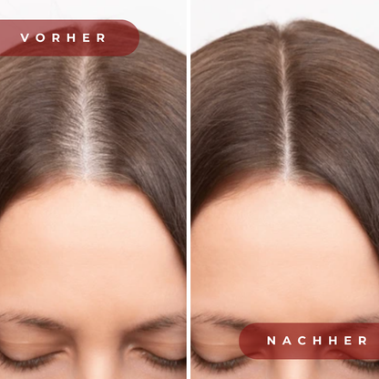 HairVital Pro