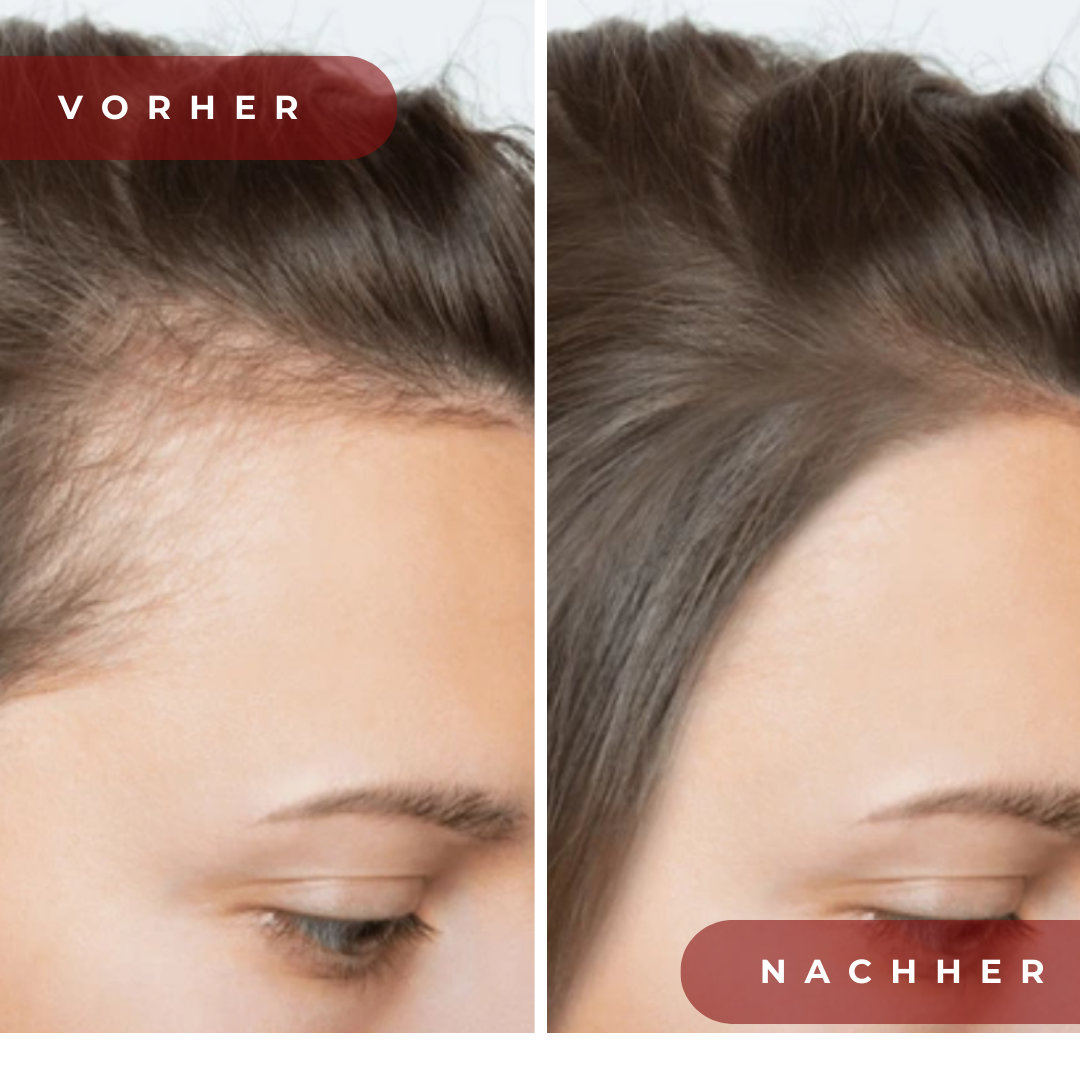 HairVital Pro