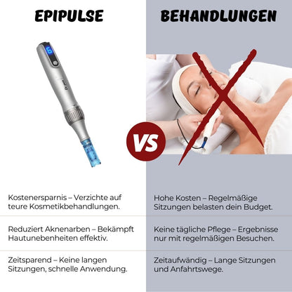 EpiPulse